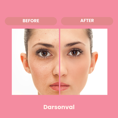 DARSONVAL - Soin haute fréquence visage et cuir chevelu