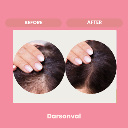 DARSONVAL - Soin haute fréquence visage et cuir chevelu